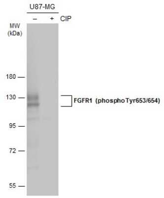 Western Blot: FGFR1 [p Tyr653, p Tyr654] Antibody [NBP3-13251]